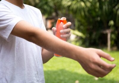 Mosquito Bites in Sri Lanka